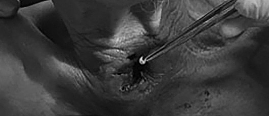 Kinh di canh gap hon 30 con gioi lam to trong khi quan benh nhan