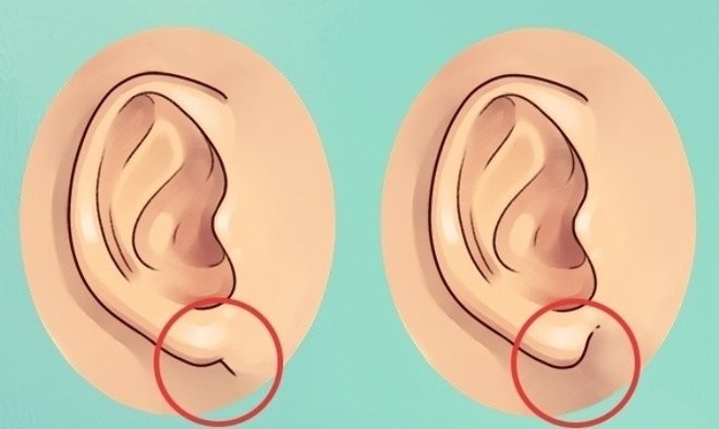 5 net tuong la ‘lo tien chon’ tren mat phu nu