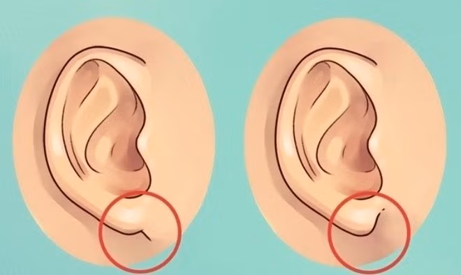 5 net tuong la ‘lo tien chon’ tren mat phu nu