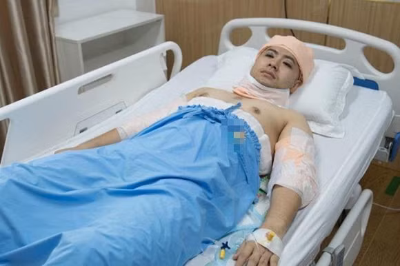 Bị nhiều người chê bai ngoại hình, nam ca sĩ quyết định "lột xác" bằng can thiệp phẫu thuật thẩm mỹ. Anh chi 300 triệu để hút mỡ, tạo hình 6 múi, bấm mí và cấy tóc.