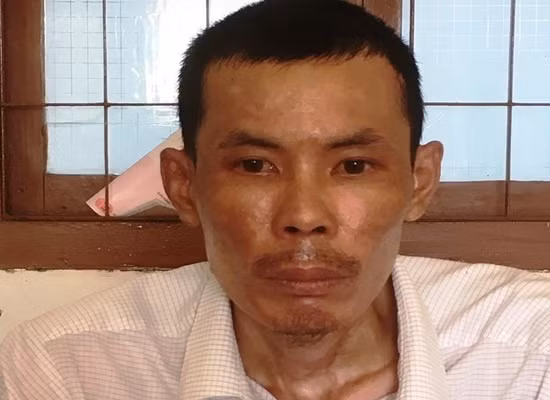 Khong chiu nau com, vo bi chong nhan tam thieu song