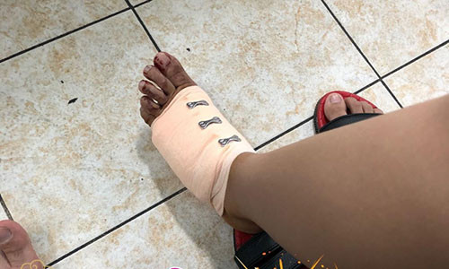 Phan Manh Quynh gap tai nan ngay 8/3, ban gai khau 20 mui-Hinh-2