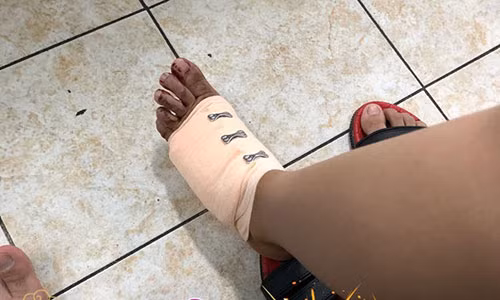 Phan Manh Quynh gap tai nan ngay 8/3, ban gai khau 20 mui-Hinh-2