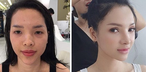 Ket vien man cua me bim sua Ha Noi chiu choi “dap di xay lai”