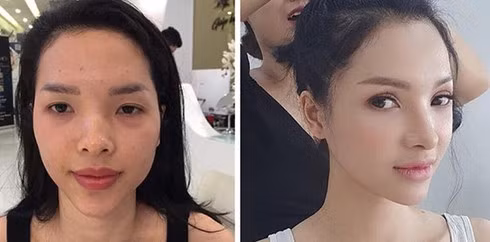 Ket vien man cua me bim sua Ha Noi chiu choi “dap di xay lai”