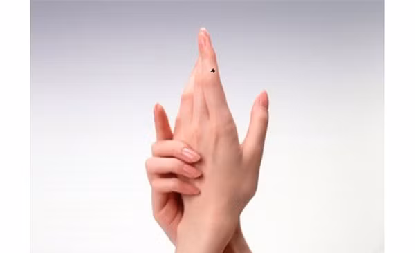 Phu nu co not ruoi o ban tay phai biet dieu nay de tranh do vo