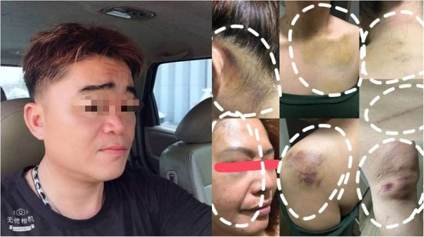 Chong danh vo toi bien dang, bao hanh con cai gay sung sot