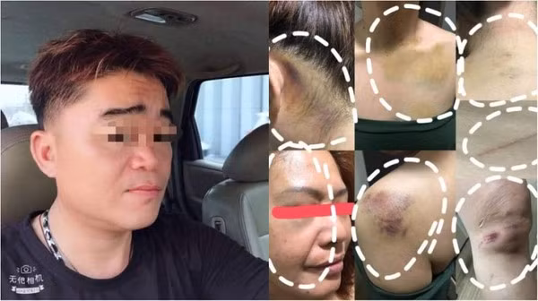 Chong danh vo toi bien dang, bao hanh con cai gay sung sot