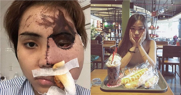 Co gai bi chong sap cuoi tat axit tiet lo loi cuoi cua hung thu-Hinh-2