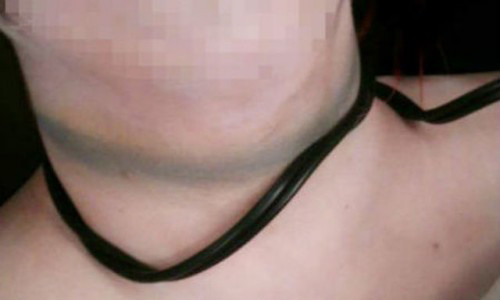 Tam giu hinh su con trai 9X dung that lung siet co me den chet