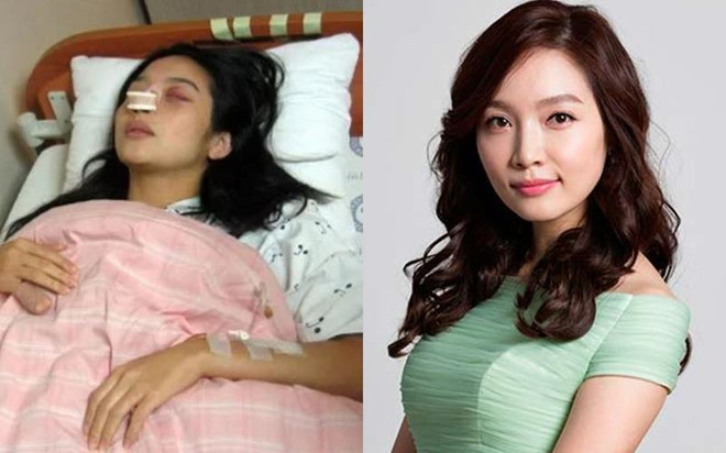 Loat minh tinh Han Quoc tung bi chong danh den muc phai nhap vien-Hinh-3