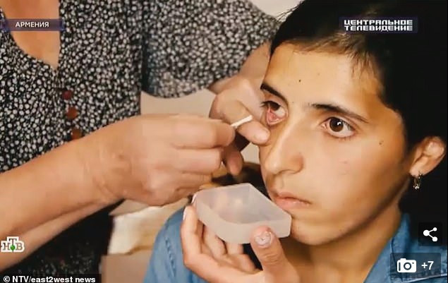 Nghi ngo hien tuong co gai khoc ra pha le