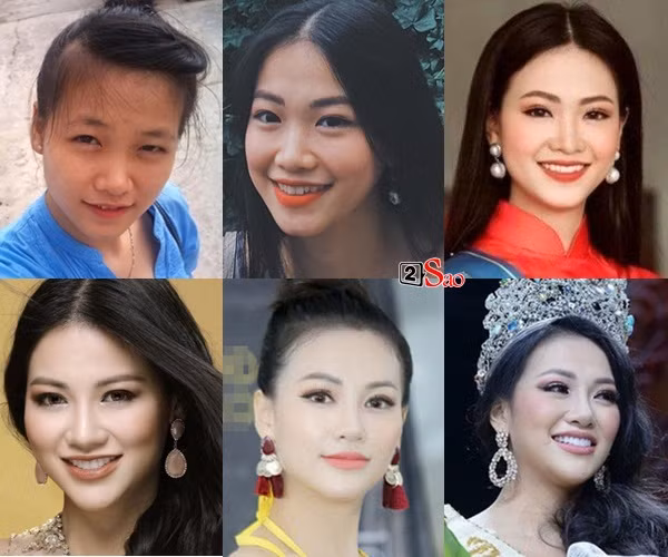 HH Phuong Khanh gay hoang mang voi guong mat bien doi lien hoan-Hinh-2