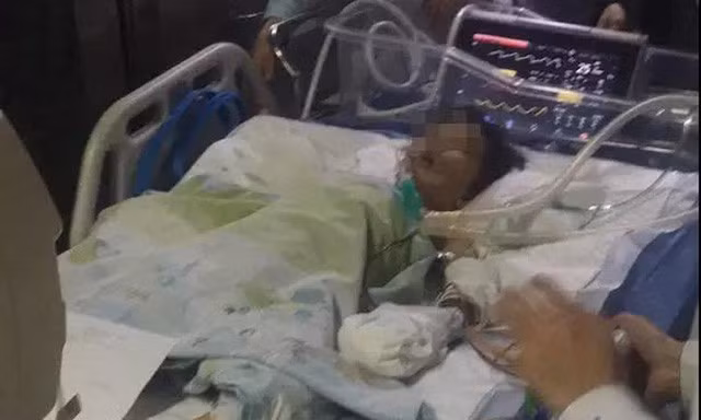 Đang nhún trên bạt lò xo, bé gái 8 tuổi gặp họa trong tích tắc Dang nhun tren bat lo xo, be gai 8 tuoi gap hoa trong tich tac