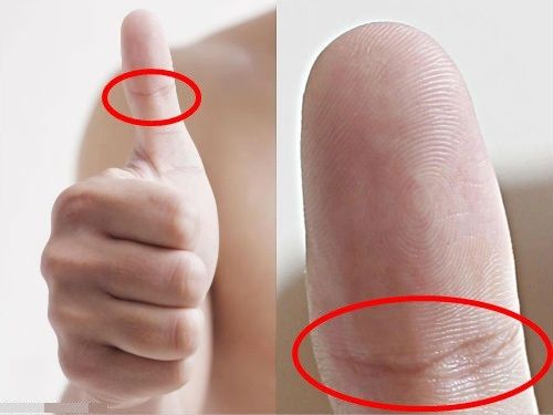 Đốt thứ hai của ngón cái có vệt lằn ngang: Theo cách xem bói ngón tay cái, vệt lằn ngang ở đốt thứ hai của ngón tay cái chính là dấu hiệu của tài lộc, bởi người sở hữu đặc điểm này không chỉ có tiền mà còn có địa vị, có tiếng nói trong xã hội.