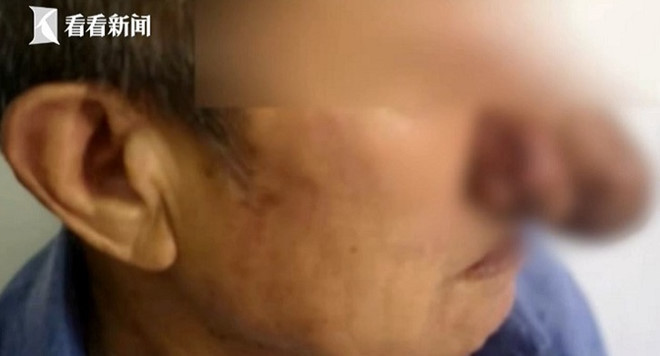 Mui dai ra nhu phu thuy vi nghien ruou suot 10 nam