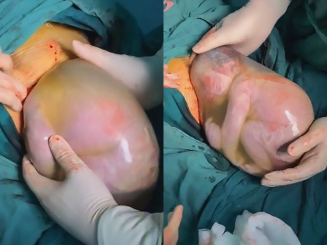 Hy huu: Be trai sinh non con nguyen trong tui oi, nhan nho khong muon ra ngoai-Hinh-2