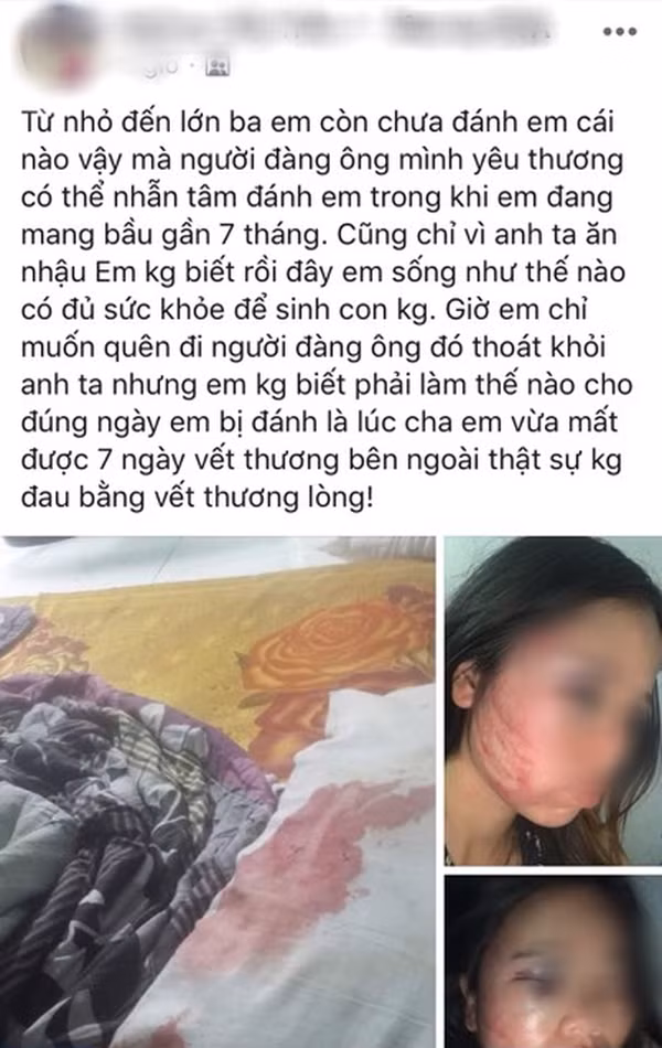 Phan no vo bau 7 thang bi chong nhan tam danh dap khong thuong tiec