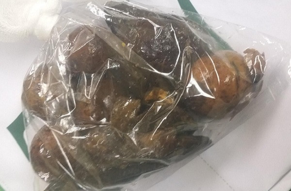 Da day nguoi dan ong chua toan hat xoai, qua chanh leo nguyen dang