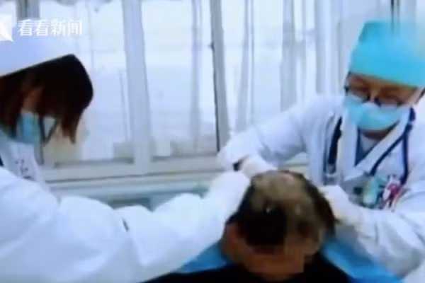 Khon kho cau cuu bac si vi vo nham chai thuoc tru sau de goi dau