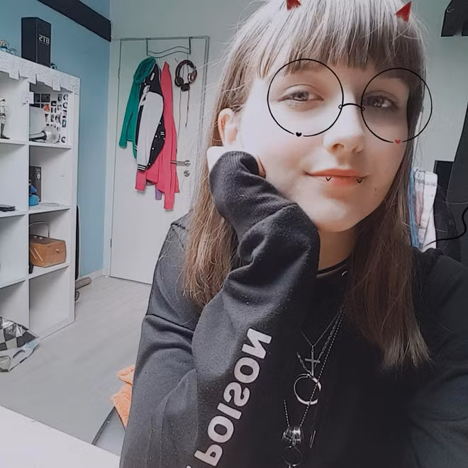 Trao luu phau thuat de giong anh 'song ao' tren mang xa hoi-Hinh-2