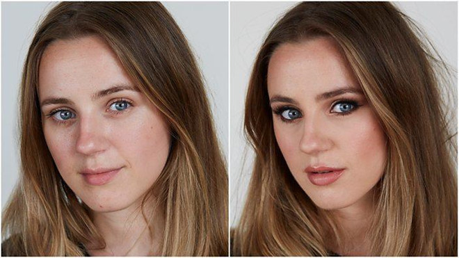 Trao luu phau thuat de giong anh 'song ao' tren mang xa hoi