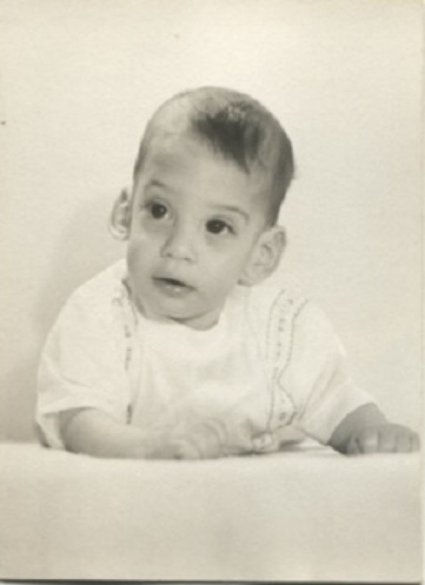 Bi an dich benh mu loa hoanh hanh tre so sinh My-Hinh-2