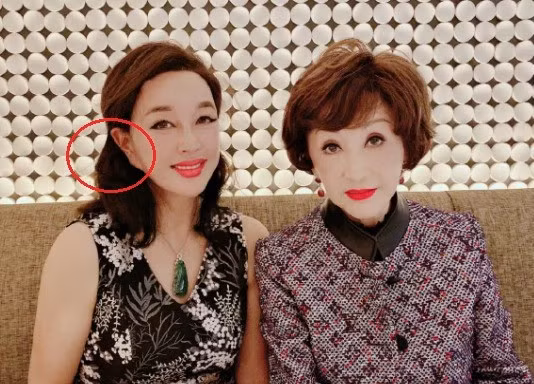 Fan la o vi hinh anh Luu Hieu Khanh bi chinh sua qua tay lo lieu