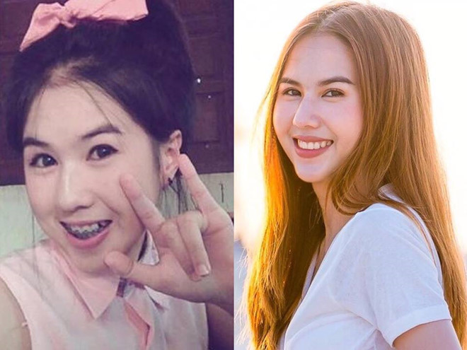 Hình ảnh "dậy thì thành công" năm 2009-2019 được cô nàng 24 tuổi chia sẻ trên trang cá nhân. "Ngày xưa thích màu hồng xinh xắn quá đi", 9X viết.