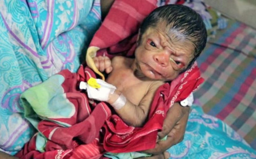 Choáng váng em bé chào đời trong hình hài... ông lão 80 Choang vang em be chao doi trong hinh hai... ong lao 80