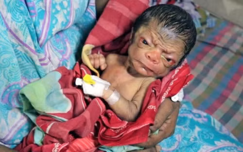 Choáng váng em bé chào đời trong hình hài... ông lão 80 Choang vang em be chao doi trong hinh hai... ong lao 80