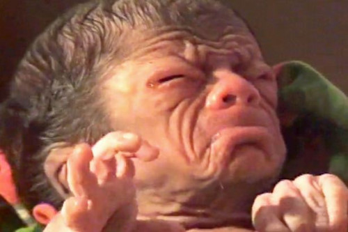 Choáng váng em bé chào đời trong hình hài... ông lão 80 - Hình 2 Choang vang em be chao doi trong hinh hai... ong lao 80-Hinh-2