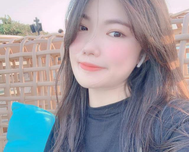 Hanh trinh lay lai nhan sac sau 20 lan phau thuat cua co gai bi tat axit-Hinh-2