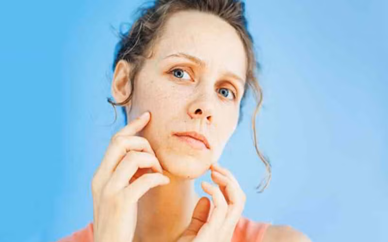 Da dẻ xanh xao: Trạng thái mệt mỏi kéo dài đồng thời do không bổ sung đủ chất dinh dưỡng có thể khiến da trở nên xanh xao, thiếu sức sống. Nếu tình trạng này kéo dài bạn nên tiến hành khám sức khỏe để chuẩn đoán bệnh sớm nhất có thể.