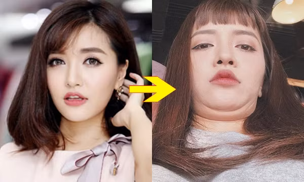 5 net di tuong nhung lai du bao tai van vuong phat bat ngo