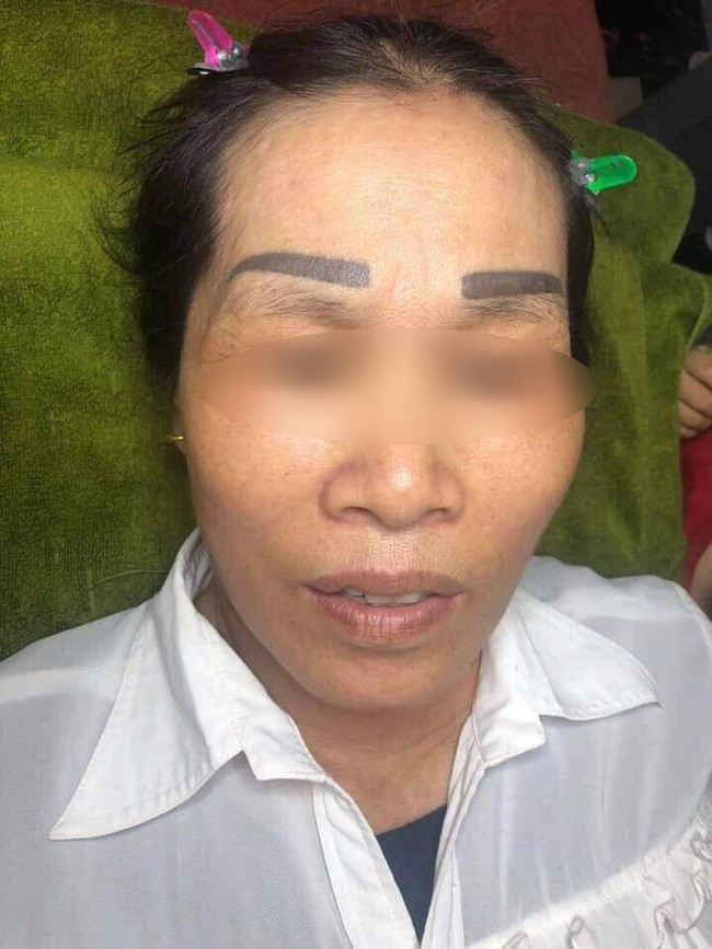 Di lam dep, nguoi phu nu cay dang nhan ve cap long may de doi