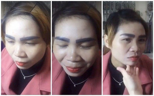 Di lam dep, nguoi phu nu cay dang nhan ve cap long may de doi-Hinh-2