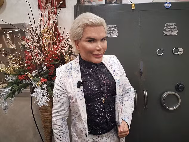 Bup be Ken lai sua mui, thu nho mat, can moc ky luc 69 lan 