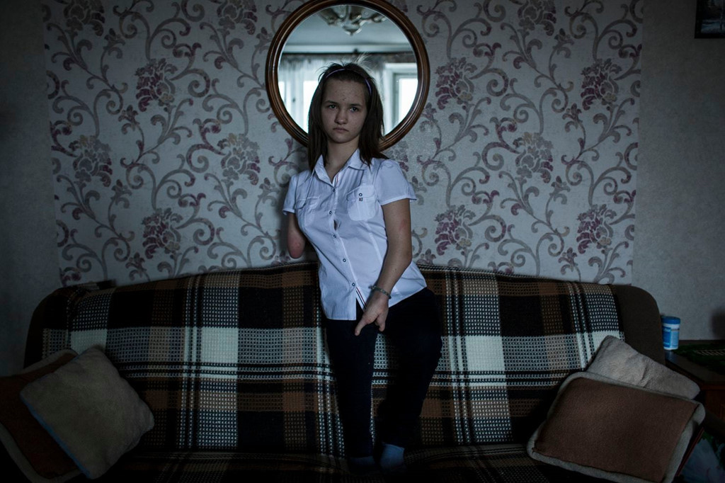 Polina bị bỏ lại ngay sau khi được sinh ra ở một trại trẻ mồ côi phía nam Belarus. May mắn là ngay sau đó có một gia đình nhận nuôi cô. Những dị tật sơ sinh của cô gái được cho là có liên quan đến việc mẹ ruột của cô sinh năm 1986.