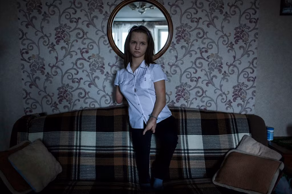 Polina bị bỏ lại ngay sau khi được sinh ra ở một trại trẻ mồ côi phía nam Belarus. May mắn là ngay sau đó có một gia đình nhận nuôi cô. Những dị tật sơ sinh của cô gái được cho là có liên quan đến việc mẹ ruột của cô sinh năm 1986.