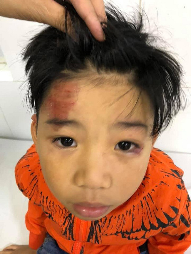 Con trai nguoi mau Ha Vy bi o to dam chan thuong-Hinh-2