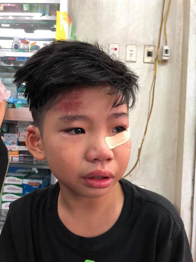 Con trai nguoi mau Ha Vy bi o to dam chan thuong