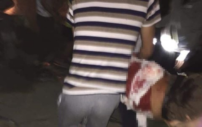 Bi dam tu vong vi can ngan em ho khong nen mang chui vo con