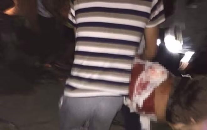 Bi dam tu vong vi can ngan em ho khong nen mang chui vo con