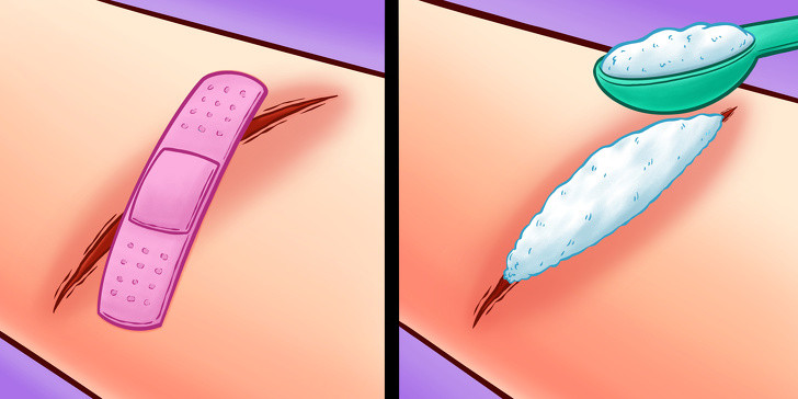 Sẹo: Khi bị thương, bạn có thể lo rằng vết thương sẽ để lại sẹo. Thuốc muối có các thành phần khử trùng giúp ngăn sự hình thành sẹo, loại bỏ phần vảy cứng, đồng thời ngăn nhiễm trùng. Thuốc muối khi pha với nước cũng có thể sử dụng để sát trùng.