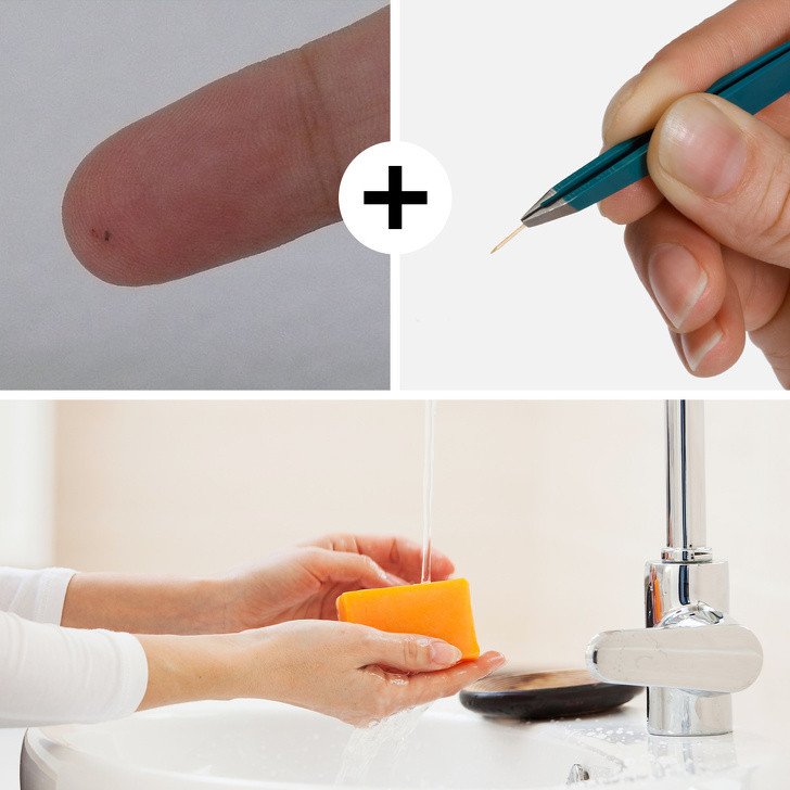 Dằm găm vào da: Dằm (các mảnh gỗ, thủy tinh, nhựa,... nhỏ) chứa đầy vi khuẩn và dễ gây nhiễm trùng trên vết thương hở. Vì vậy, bạn luôn phải sát trùng khi xử lí vết thương. Nếu bạn có một mảnh dằm găm sâu vào da, bạn cần sát trùng vết thương và lấy mảnh dằm ra bằng đầu kim đã được tiệt trùng bằng nước sôi; sau đó rửa sạch bằng xà phòng và nước.