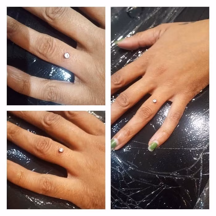 Xỏ khuyên ngón tay Cách khác thường nhất để đeo kim cương là đặt kim cương vào trong ngón tay. Thủ thuật này không mất hơn một vài phút. Chuyên gia sẽ cắt một vết cắt nhỏ và đặt một tấm titan bên trong. Viên kim cương được gắn vào tấm titan. Nhưng có một số tác dụng phụ bạn cần biết. Nếu không làm cẩn thận da của bạn sẽ bị tổn thương. Và nếu bạn sử dụng loại kim cương này, thay vì nhẫn cưới, nó sẽ để lại sẹo nếu bạn muốn ly hôn.