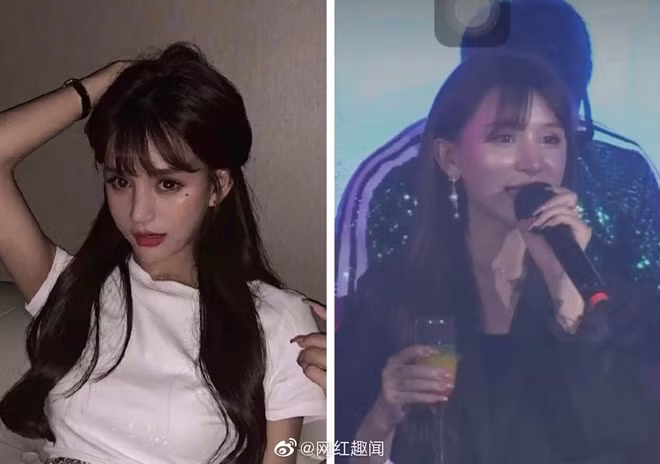 Vương Đậu Đậu lộ khuôn mặt cứng đờ, kém tự nhiên vì phẫu thuật thẩm mỹ.