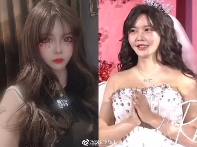 Nhan sắc trong ảnh selfie và ngoài đời của cô dâu Hàn An Nhiễm. Gương mặt của cô được nhiều dân mạng đánh giá là đơ cứng, thậm chí trông khá đáng sợ do lạm dụng phẫu thuật thẩm mỹ.