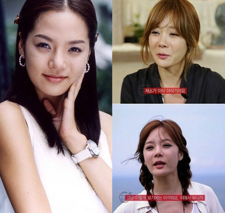 "Nữ thần không tuổi" Chae Rim cũng không tránh khỏi sự tàn phai nhan sắc so với ảnh ngày trẻ. Giờ đây Chae Rim sống hạnh phúc bên ông xã người Trung Quốc - nam diễn viên Cao Tử Kỳ.